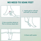 Gorgellux Callus Remover for Feet, Callus Remover Gel & Foot File Kit, Foot - Image 7