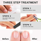 Professional Cuticle Trimmer Nail Cuticle Cutter Stainless Steel Cuticle Nippers - Image 4