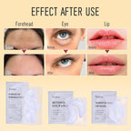 Yeokoe Forehead Wrinkle Patches, Under Eye Patches and Lip Mask 30 PCS. Face - Image 6