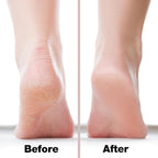 Probelle Double Sided Multidirectional Nickel Foot File Callus Remover - Image 4