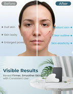 Gua Sha Facial Tools, Guasha Tool - Image 6