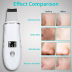 Face Scrubber Skin Spatula - Image 3