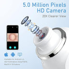 Blackhead Remover Vacuum, USB Interface Type Pore Vacuum, Men and Women Pore - Image 2