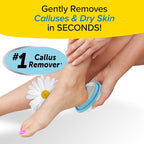PedEgg Foot File – Traps Shavings Inside - Image 2