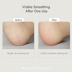 BUFFOUT Callus Eraser Exfoliating Gel – Body Care Exfoliator Scrub & Exfoliant - Image 4
