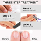 Professional Cuticle Trimmer Nail Cuticle Cutter Stainless Steel Cuticle Nippers - Image 8