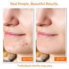 YEOUTH Skin Care Set: Vitamin C Face Wash, Vitamin C & Retinol Serum, Face Cream - Image 2