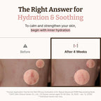 Dr.Reju-All Advanced PDRN Rejuvenating Mask - Image 4