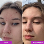 Good Molecules Niacinamide Serum Pack 3 – 30 ml Each | 10% Niacinamide Serum to - Image 4