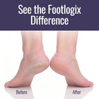 Footlogix Foot Care Callus Softener Combo - Image 4