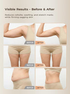 Lymphatic Drainage Massager & Anti Cellulite Massage Tool, - Image 4