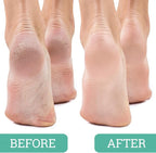 Maccibelle Salon Foot Pumice and Scrubber - Image 3