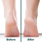 Probelle Double Sided Multidirectional Nickel Foot File Callus Remover - Image 5