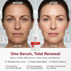 Alpha Skin Care Renewal Serum, 14% Glycolic AHA, Anti-Aging Formula, Alpha - Image 5
