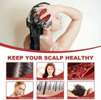 Meartchy Silicone Scalp Massager Shampoo Brush, Scalp Brush - Image 4