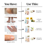 Epielle Hydrating & Moisturizing Hand & Foot Masks, Relieve and Soften Dry - Image 7