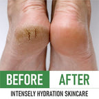 PurOrganica Urea Cream 40% – Made in USA, Maximum Strength Foot Cream - Image 5