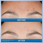 CeraVe Resurfacing Retinol Serum - Image 3