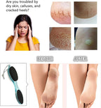 Foot File Callus Remover 4-in-1, Scrubber Brush, Foot Rasp and Sand Paper - Image 3