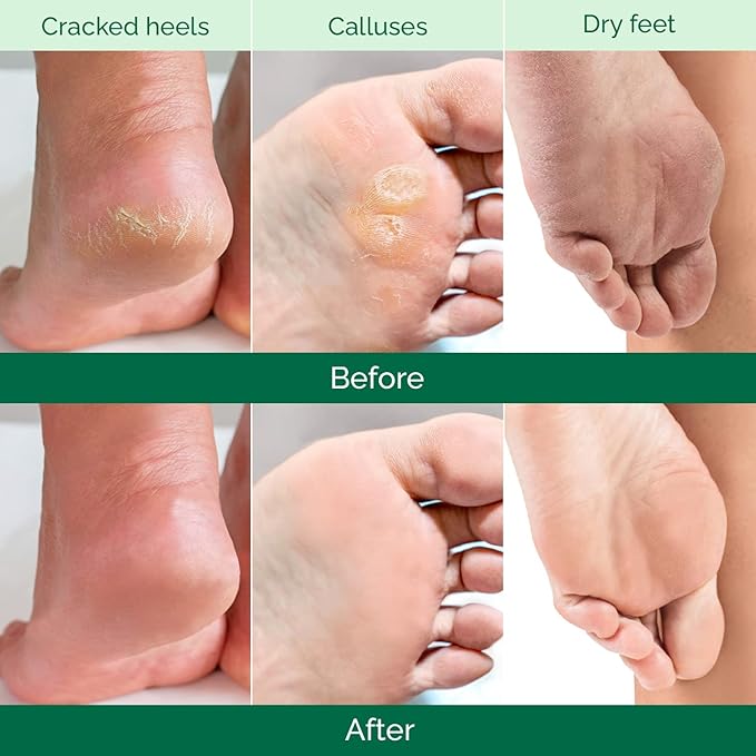 PLANTIFIQUE Foot Peeling Mask 2 Pack - Image 3
