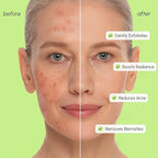 MAREE Exfoliating Toner with Salicylic Acid – AHA BHA Face Exfoliant & Pore - Image 4