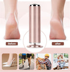 Electric Foot File Remover Callus: Profesional Pedicure Tool - Image 5