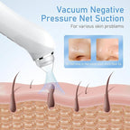 Facial Pore Blackhead Remover Vacuum, 1080P Camera Blackhead Remover, 20x Zoom - Image 2