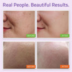 YEOUTH Skin Care Set: Hyaluronic Acid Serum, Vitamin C Serum, Face Cleanser - Image 3