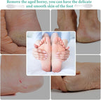 1 Pcs Stainless Steel Foot File Callus Remover Double Sided Metal Foot Rasp - Image 5