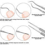 ZIZZON 7 Pcs Ingrown Toenail File and Lifters Set, Stainless Steel Ingrown - Image 4