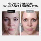 Eclat Skincare Face Serum Set – Vitamin C & Retinol Serum - Image 3