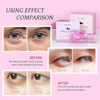PEAUAMIE Under Eye Patchs Rose Eye Mask - Image 5