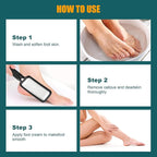 Foot Files Foot Scrubber Pedicure, Stainless Steel Callus Remover - Image 4