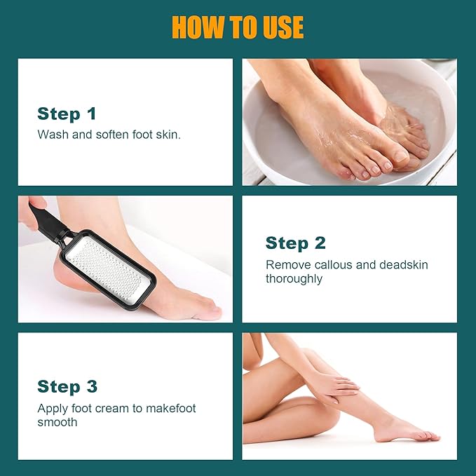 Foot Files Foot Scrubber Pedicure, Stainless Steel Callus Remover - Image 4