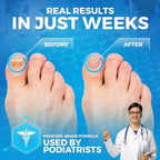 Imperial Feet Epsom Salt Foot Soak-Toenail Repair, Fungus Athletes Foot - Image 3