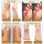 10Pack Foot Soak with Epsom Salt, Epsom Salts - Image 4