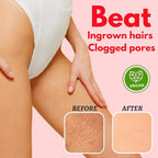 Bikini Area Exfoliator Pack 2-2% Kojic Acid Vitamin C & 7% AHA/BHA Even Skin - Image 4