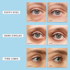 Enaskin Naturals Under Eye Patches - Image 7