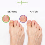 DAILY REMEDY 4-Pack - Image 6