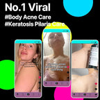 SOME BY MI AHA BHA PHA 30 Days Miracle Acne Clear Body Cleanser 13.5oz – - Image 2