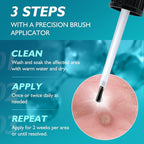 Wart Remover Freeze Off, Wart Corn Removers - Image 7