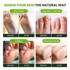 Tea Tree Oil Foot Soak with Epsom Salt - Image 5
