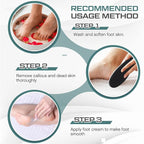 Lothee 15 Pack Foot File Foot Callus Remover Double Sided Professional - Image 4