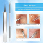 Best Blackhead Remover, Acne Whitehead Removal Kit, Pimple Comedone Extractor - Image 6