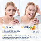 HIQILI 100ML Turmeric Oil for Face Skin Care, Aromatherapy, 100% Pure, Use - Image 2