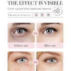 Eakroo Rose Eye Masks - Image 3