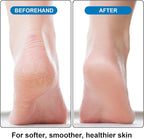 Foot Pumice Stone 2 Pack Pedicure Stone - Image 4