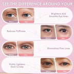 Under Eyes Patches, 40 Pairs Rose Hydrogel Eye Mask - Image 6