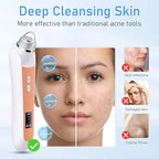 Facial Pore Blackhead Remover Vacuum, 1080P Camera Blackhead Remover, 20x Zoom - Image 4