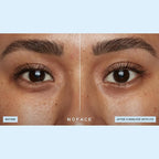 NuFACE IonPlex Hydra-Gel Power Under Eye Patches - Image 5